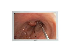 Surgical Display